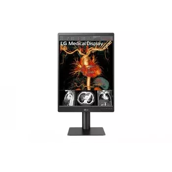 Monitor de diagnostic LG 21.3